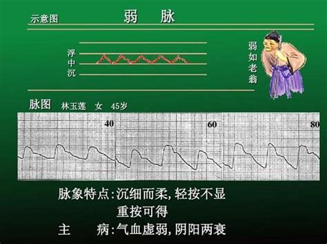 脈細數|脉细数